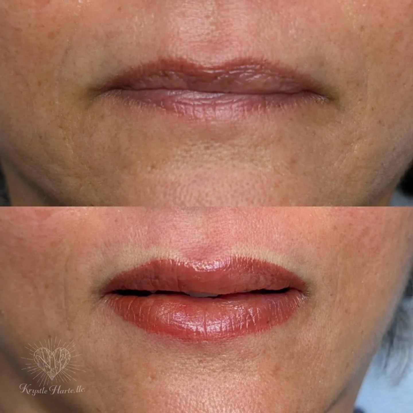 What exactly is Lip Neutralization? 💡

Ever wonder how we achieve those soft, warm lip tones on naturally cool or dark-pigmented lips? It&rsquo;s all about the art of Lip Neutralization.

Unlike a standard Lip Blush, neutralization is a specialized 