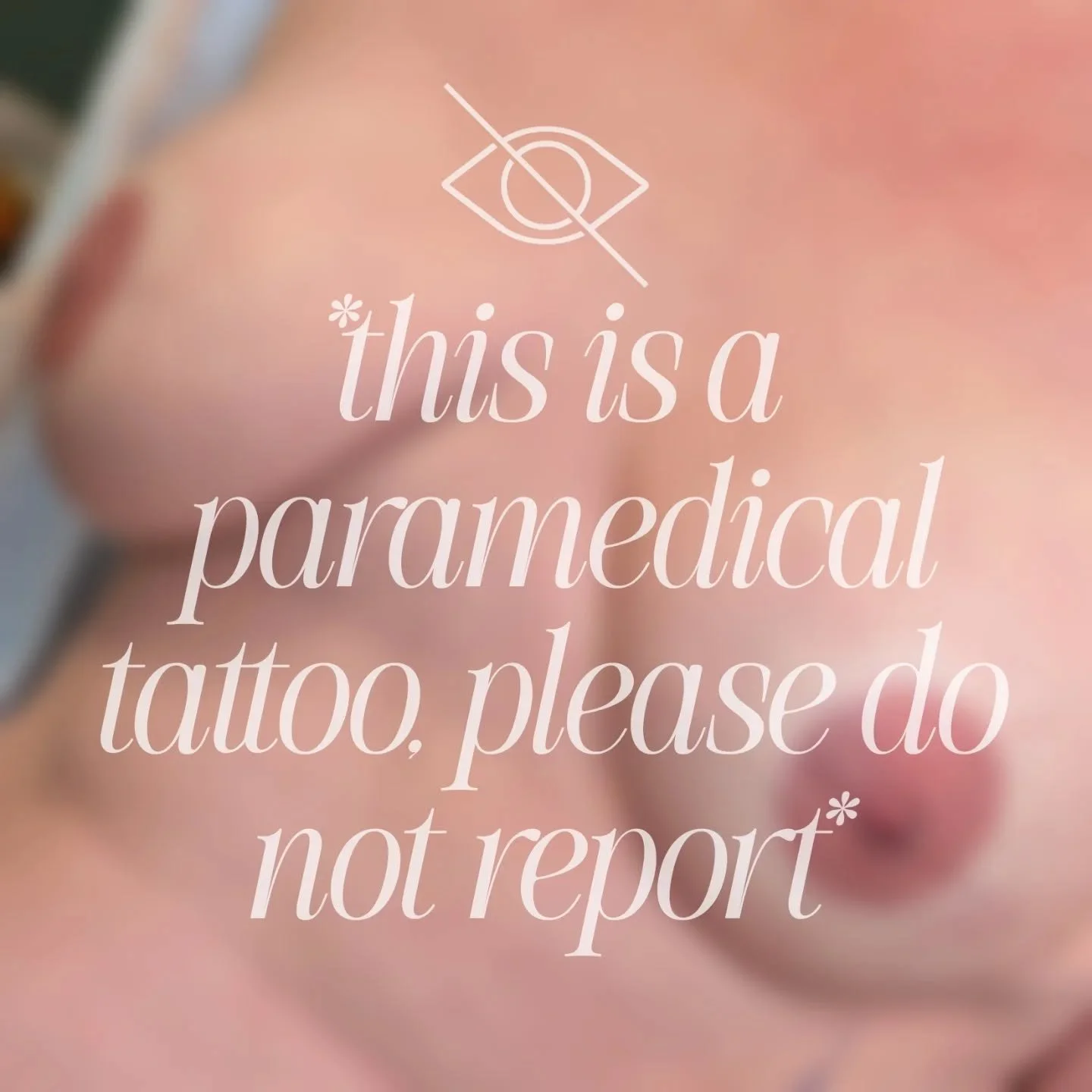 PARAMEDICAL RESTORATIVE AREOLA TATTOOING-- POST DOUBLE MASTECTOMY 

*this is a paramedical tattoo, please do not report*

#AreolaTattoo #AreolaRestoration #areolatattooing #ParamedicalTattoo