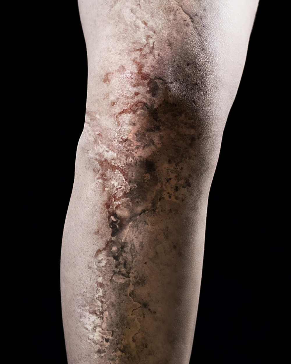 Health_Assignment_ReShoots10996.jpg