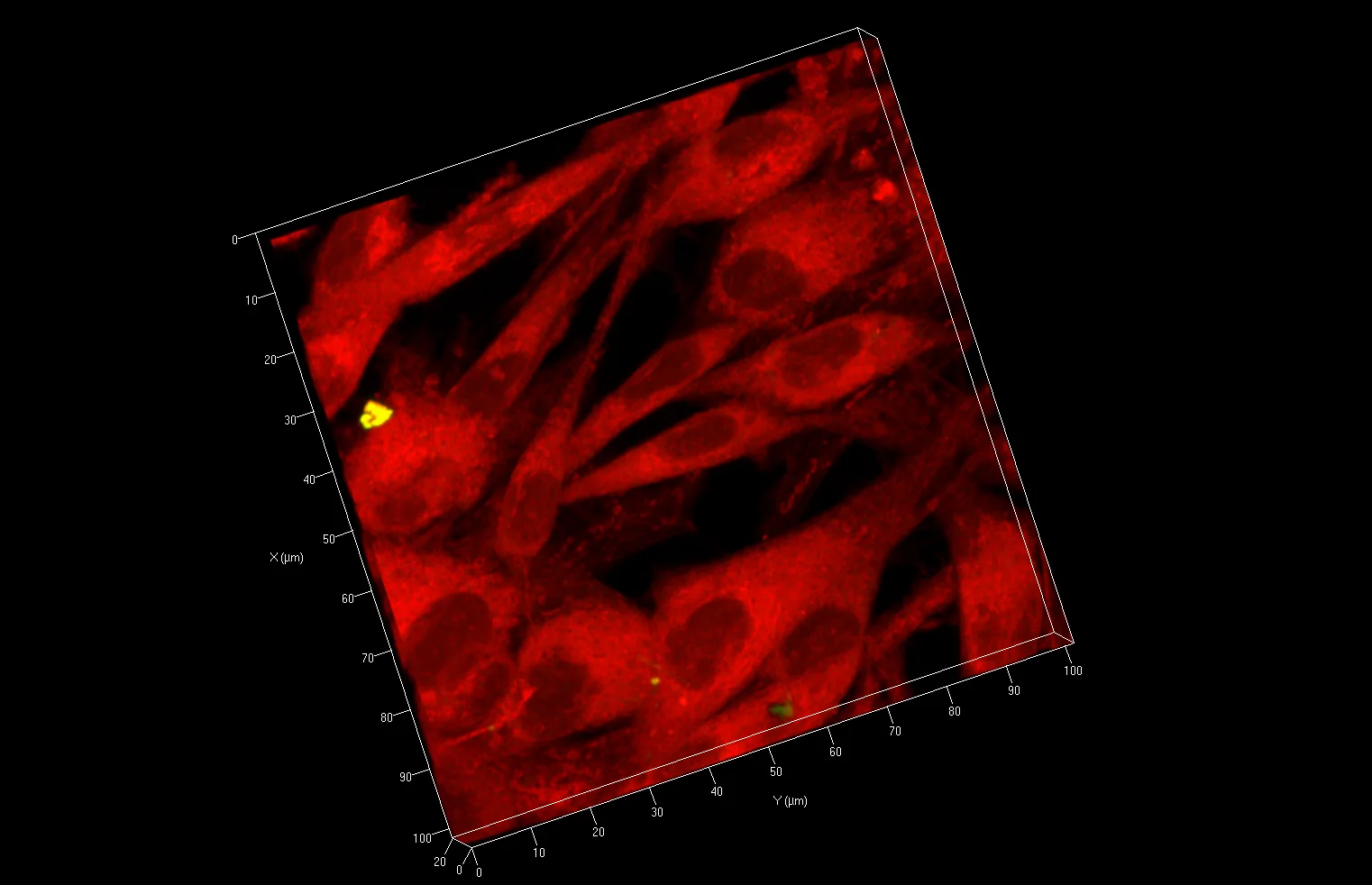 Particle Uptake (Yellow) by Synovial Fibroblasts