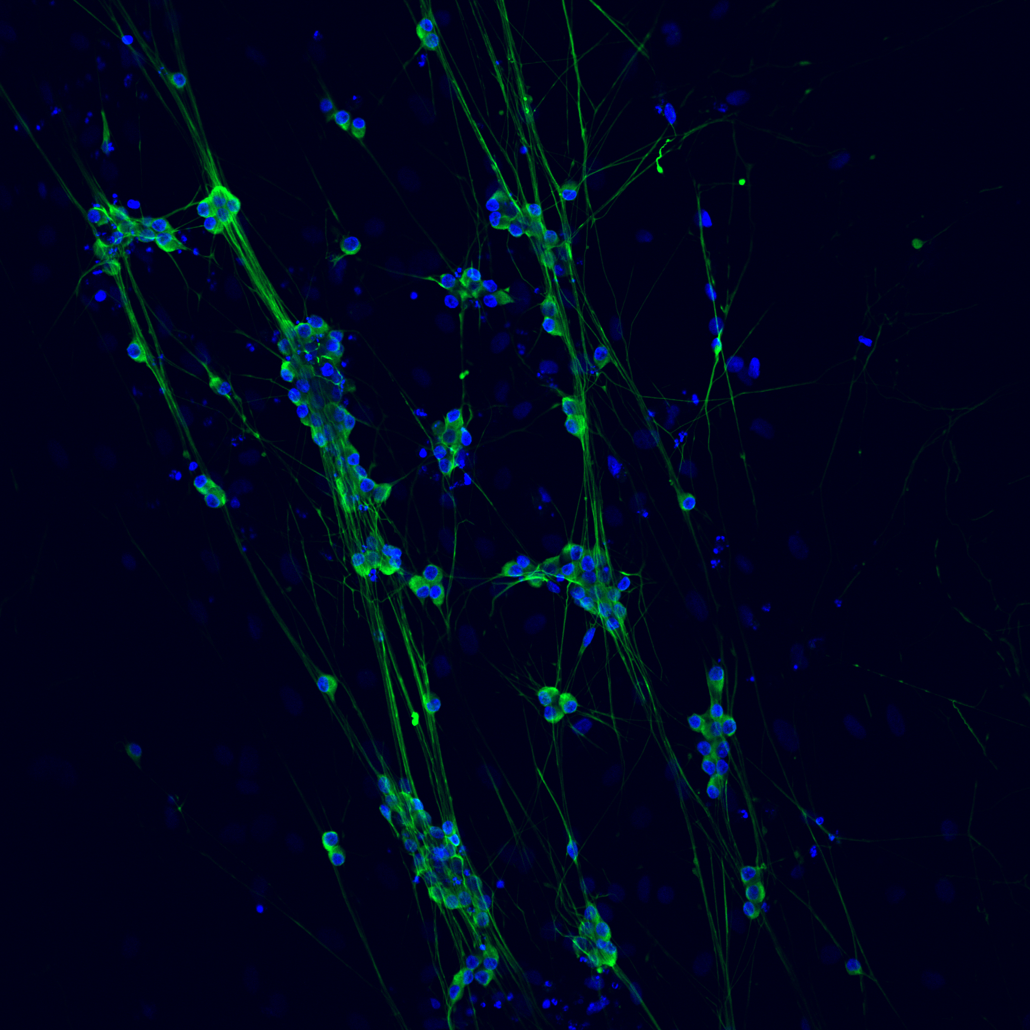  Dorsal Root Ganglion Cells Aligned on a Collagen Scaffold 