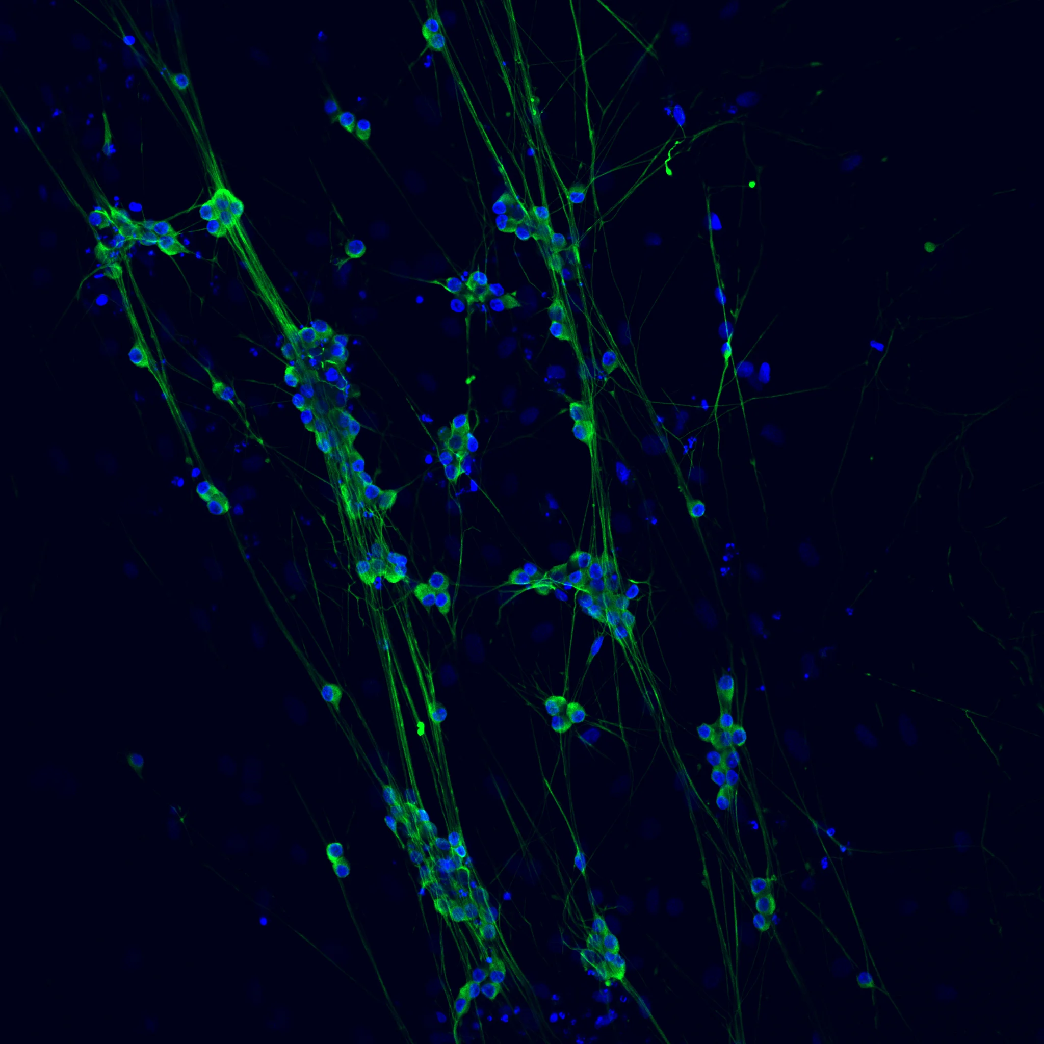 Dorsal Root Ganglion Cells Aligned on a Collagen Scaffold