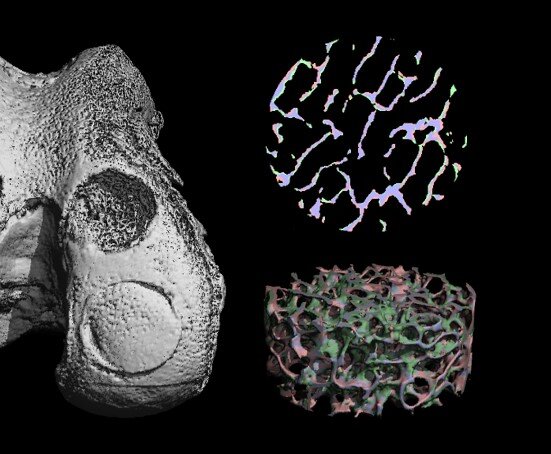 Check out our latest research published in Acta Biomaterialia