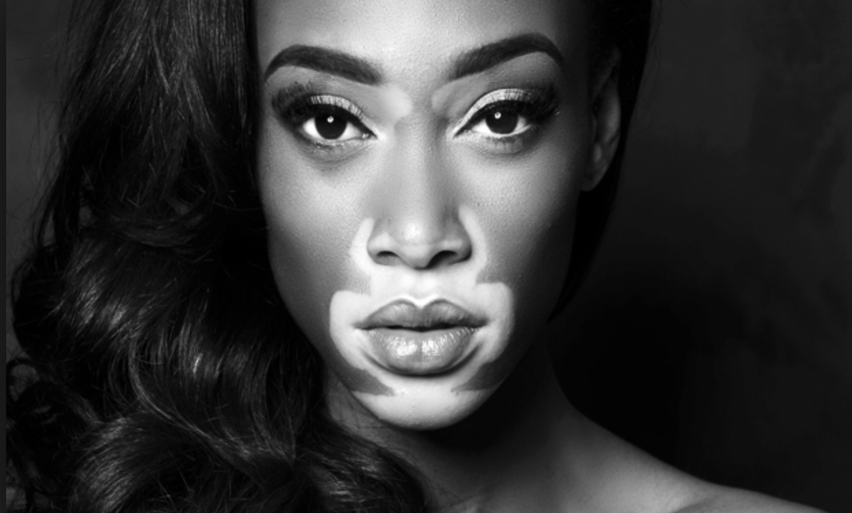 Your "imperfections" were deemed "imperfect" by someone else. You have the power to deem it beautiful. 