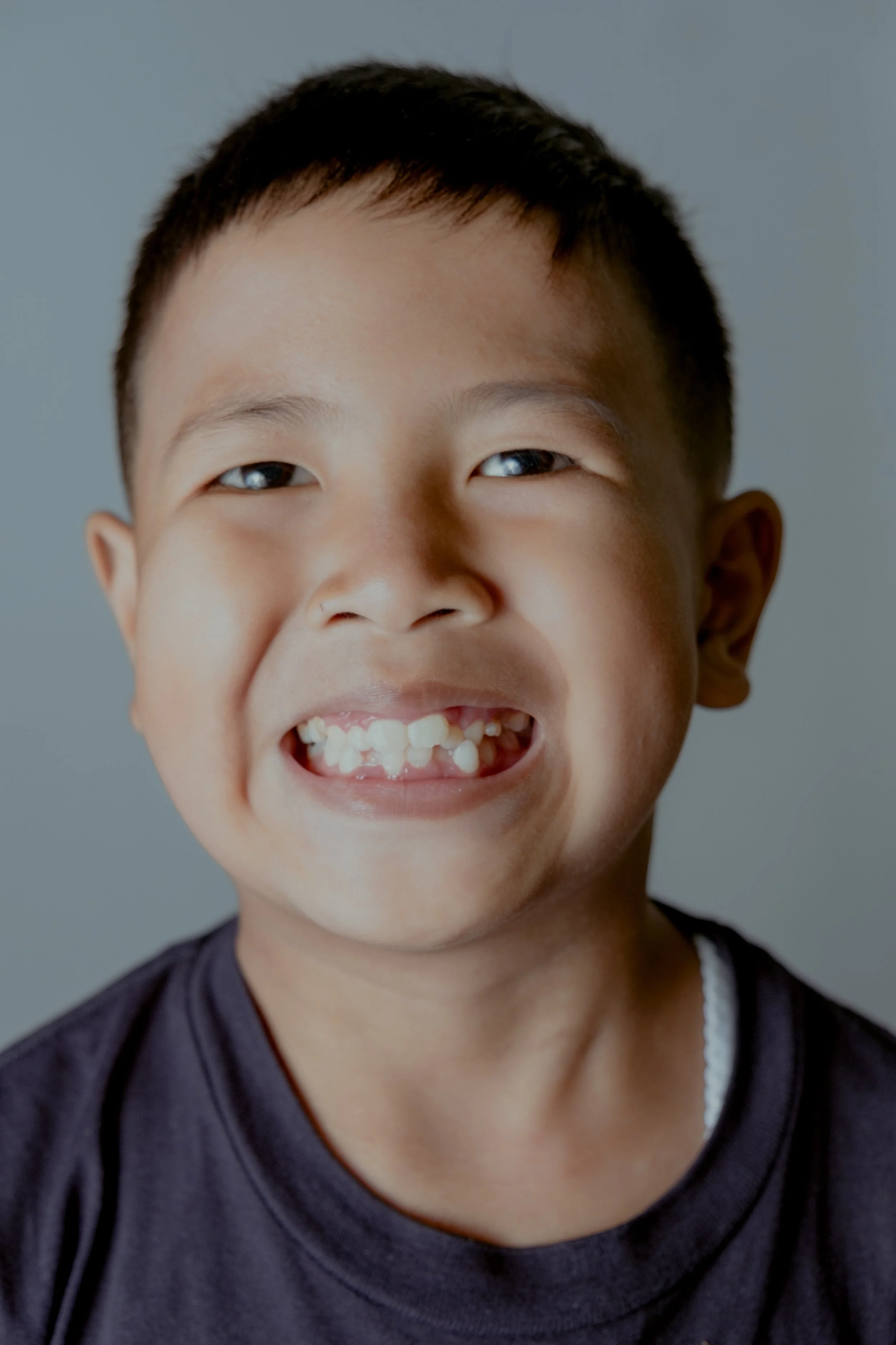 teeth.jpg