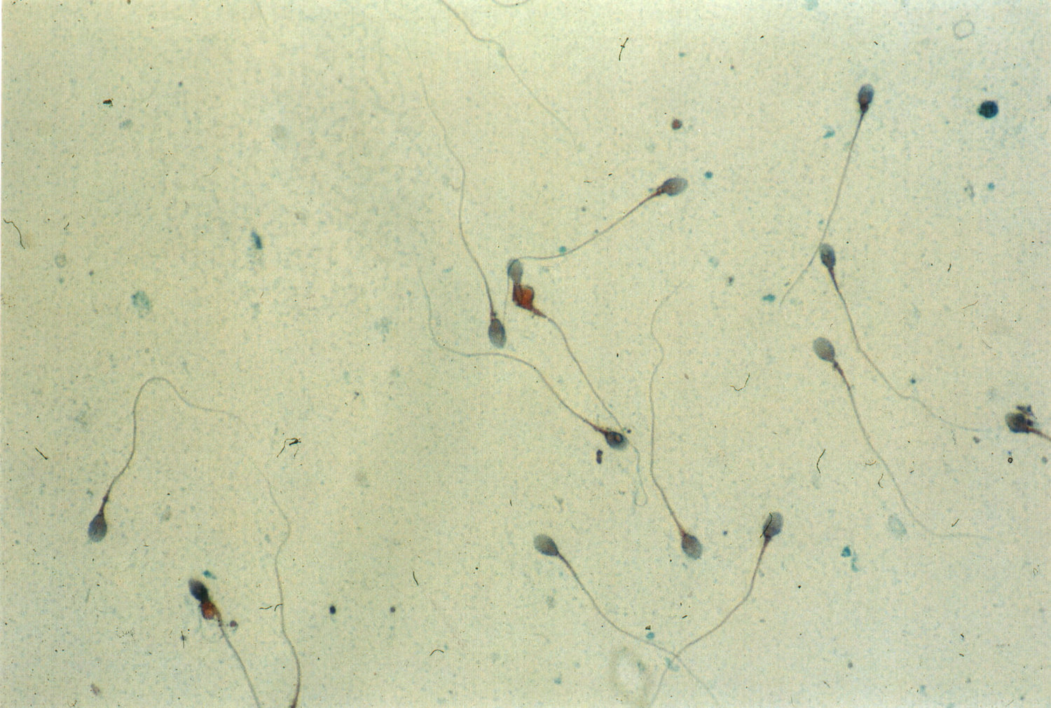 Spermiologie — Laboratoire d'Analyses Médicales à Paris