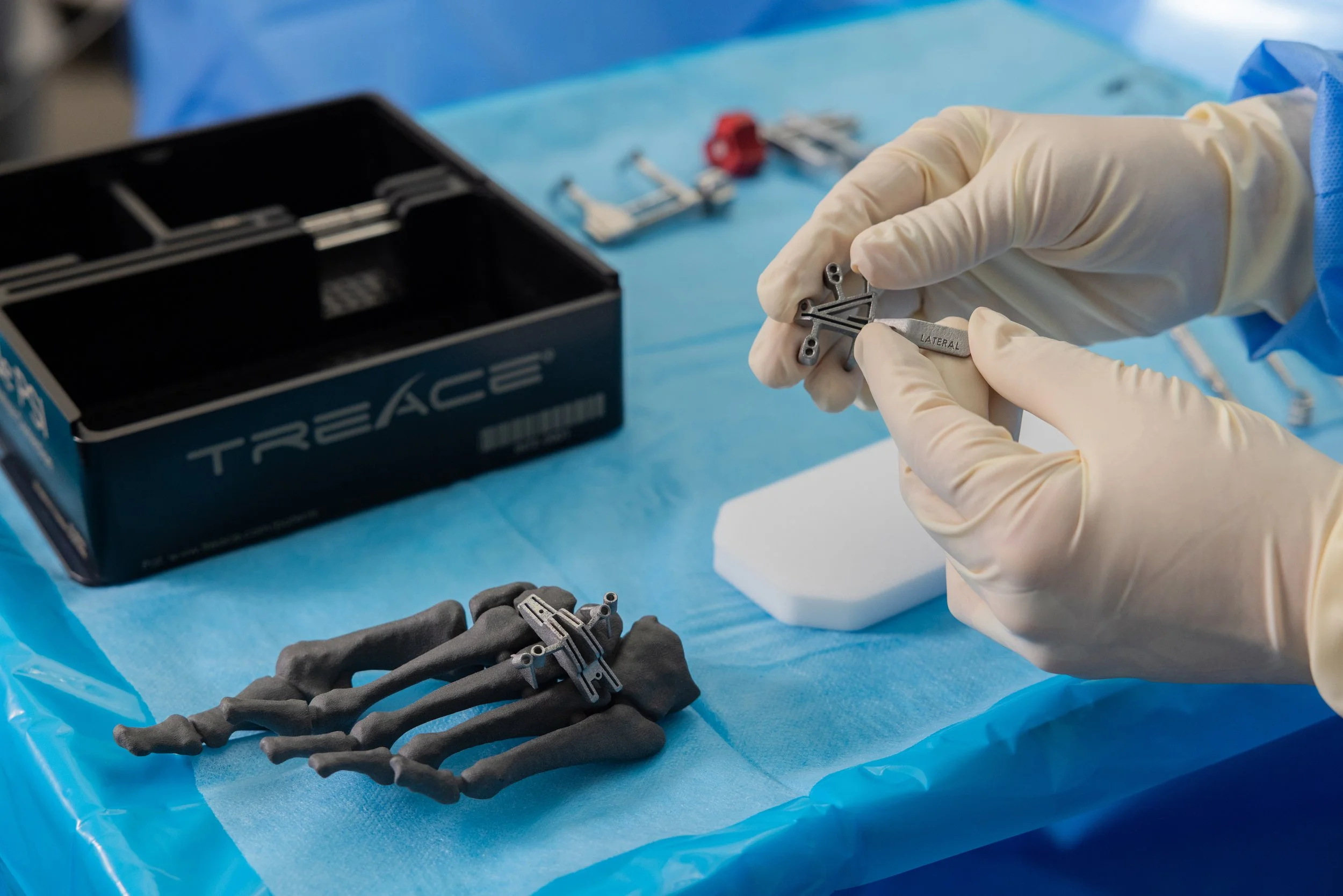 Treace Medical Concepts