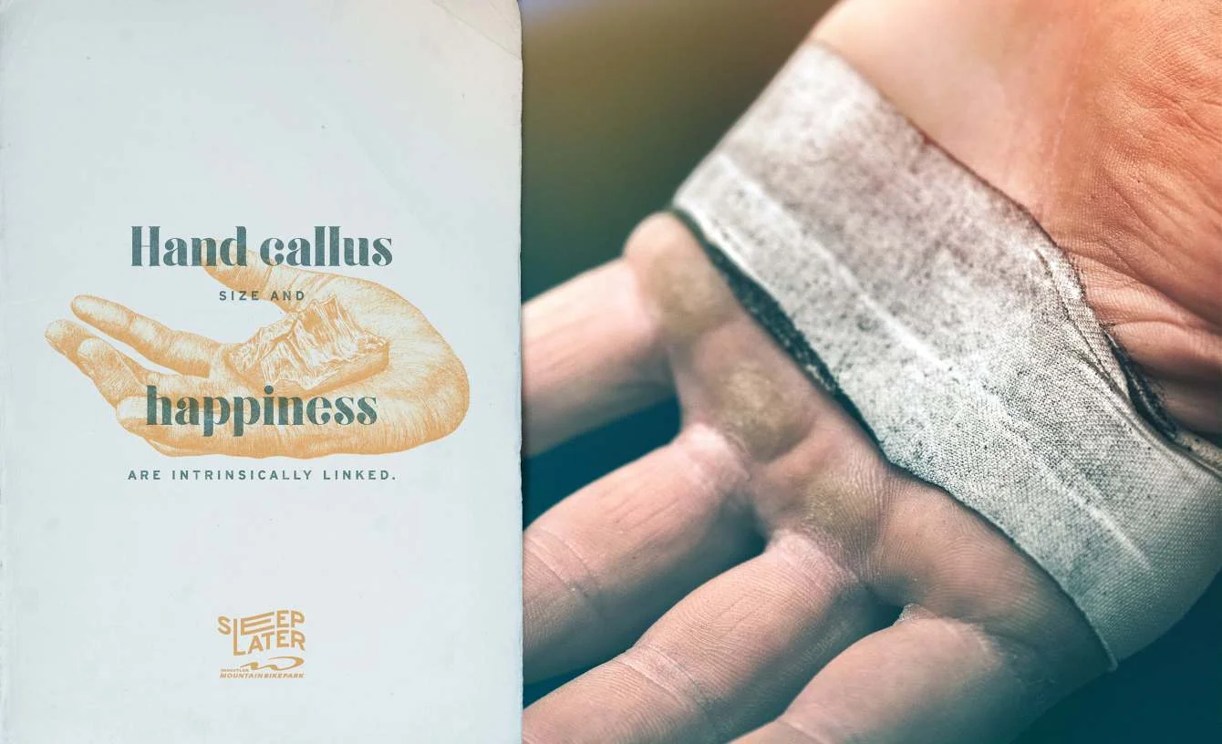 SLEEPS_HAND-CALLUS_LOW-RES_1340_c.jpg