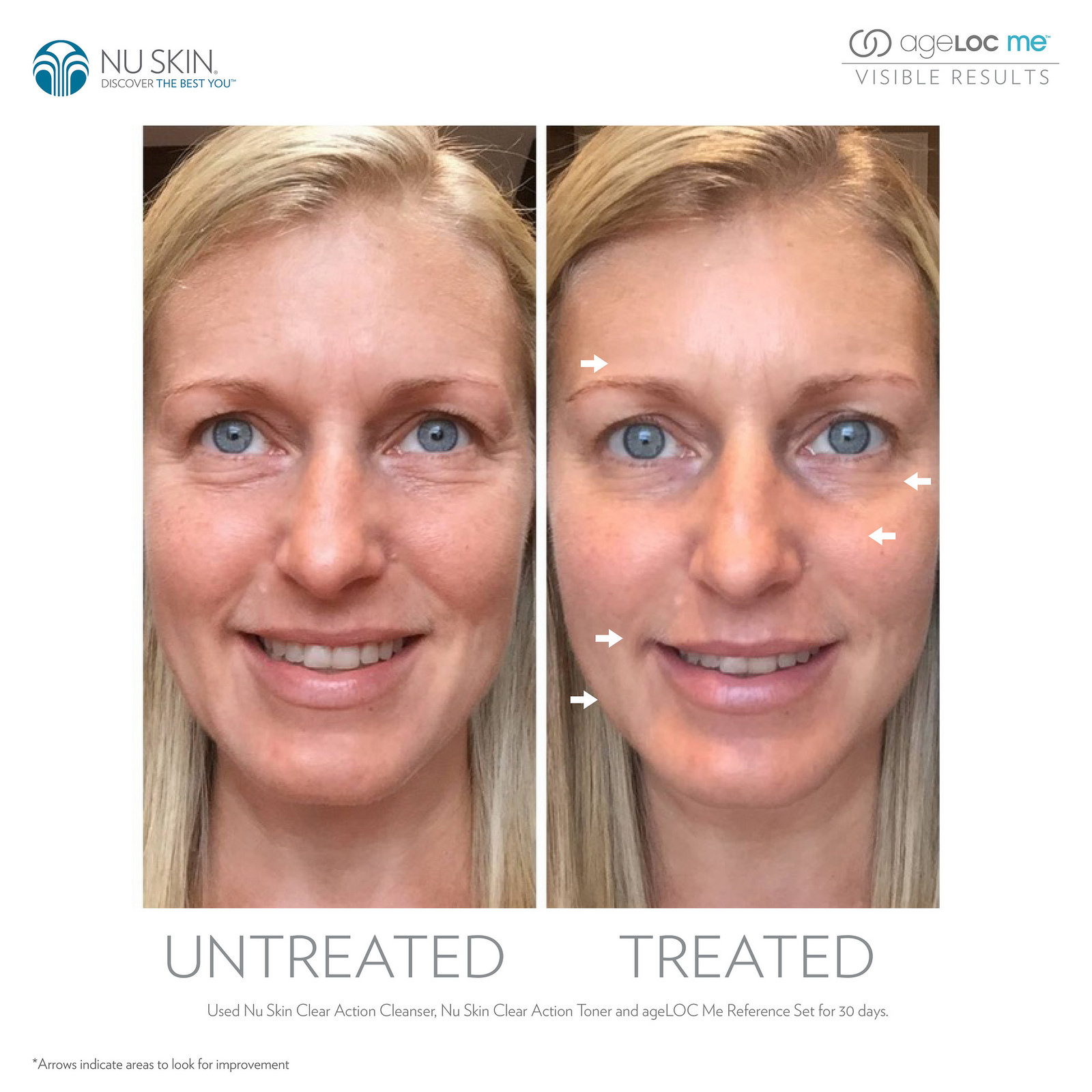 ageloc-me-results-3.jpg