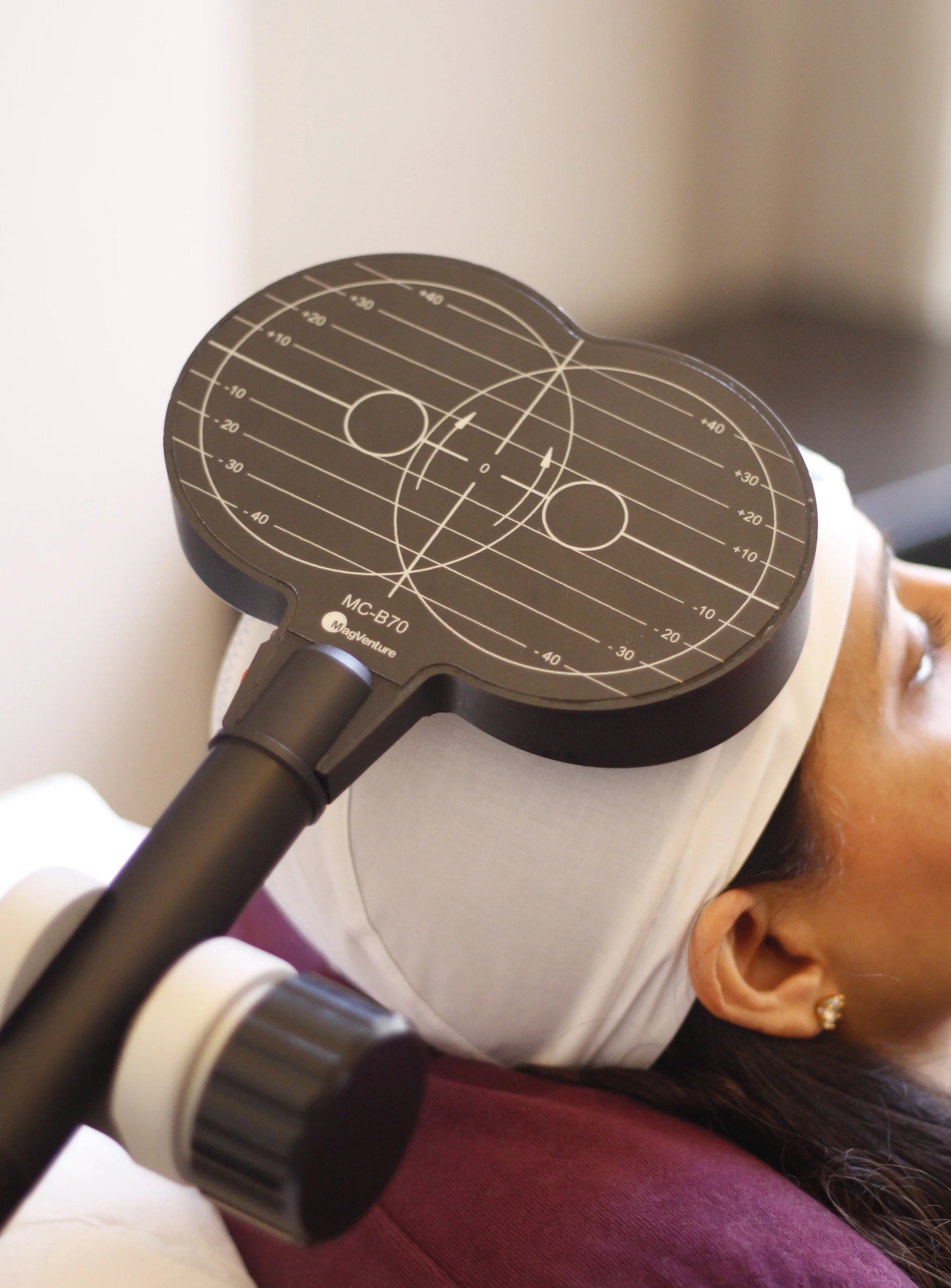 1living-mind-rtms-tms-london-harley-street-tms-integrated-therapy-depression-anxiety.jpg