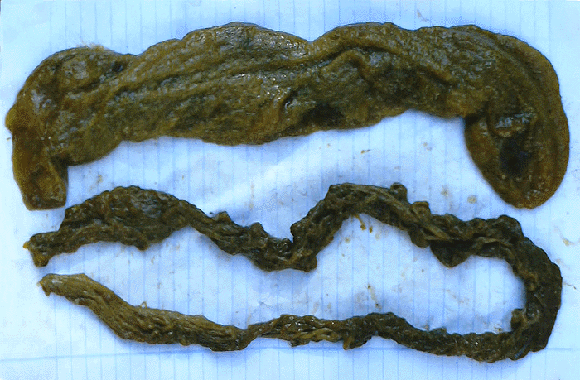 Colonic Results
