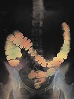 The Emotional Bowel