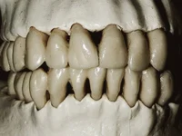 A brief History of Teeth