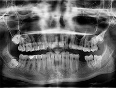 Teeth and detox
