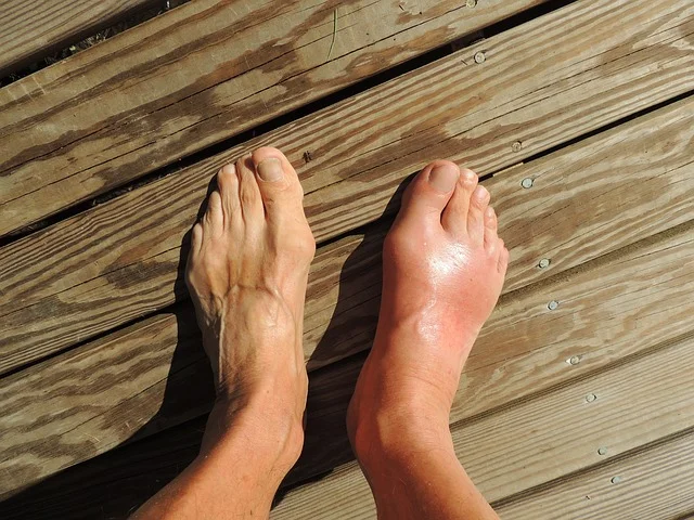 Gout and detox