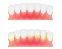 SlimyTeeth.jpg