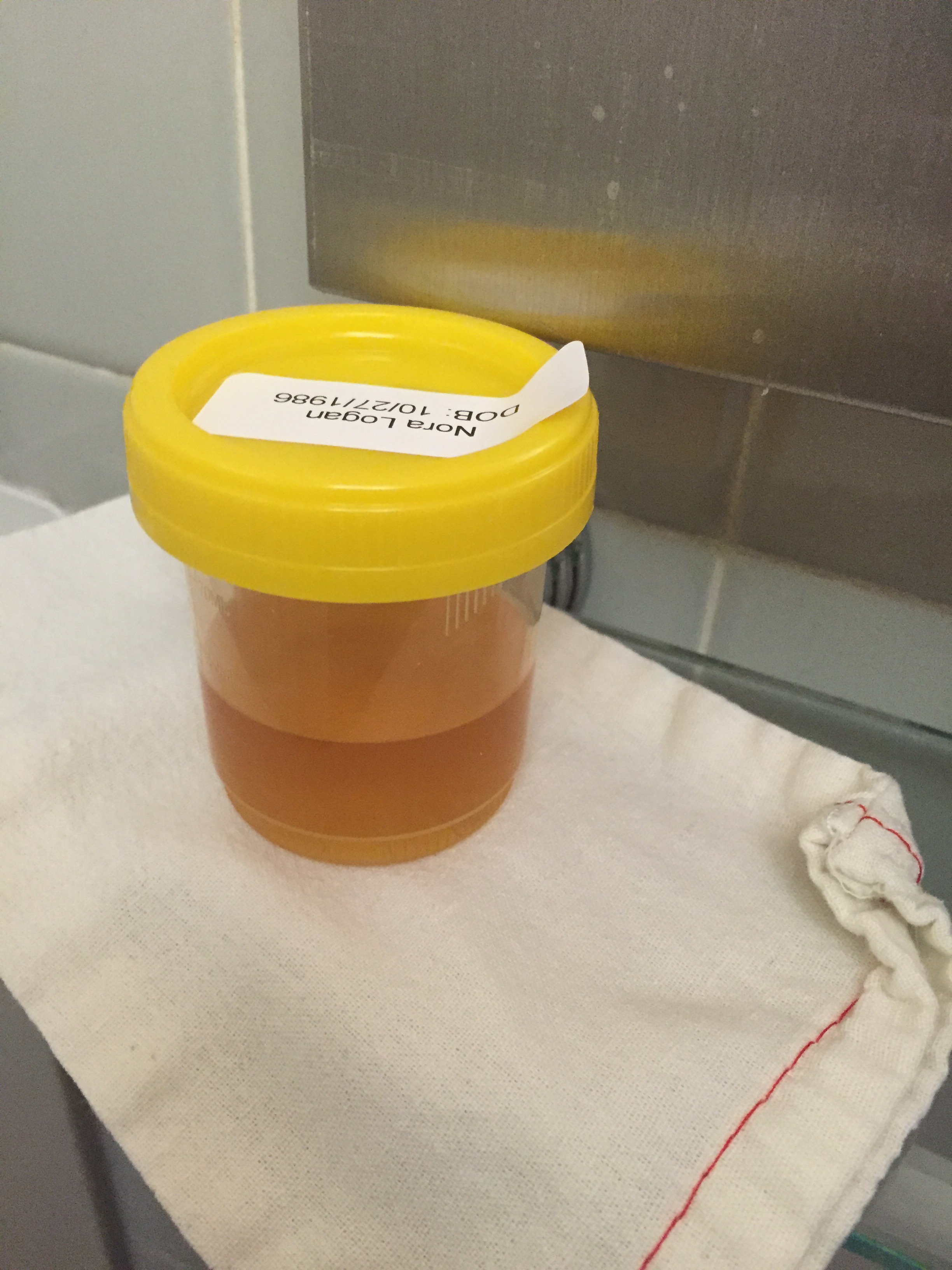 I show you this photo of my urine not as an overshare but because to give you a true life story of what you get at a bougie medical office in NYC: burlap bags for urine. Like an episode of Portlandia, but exponentially worse. 