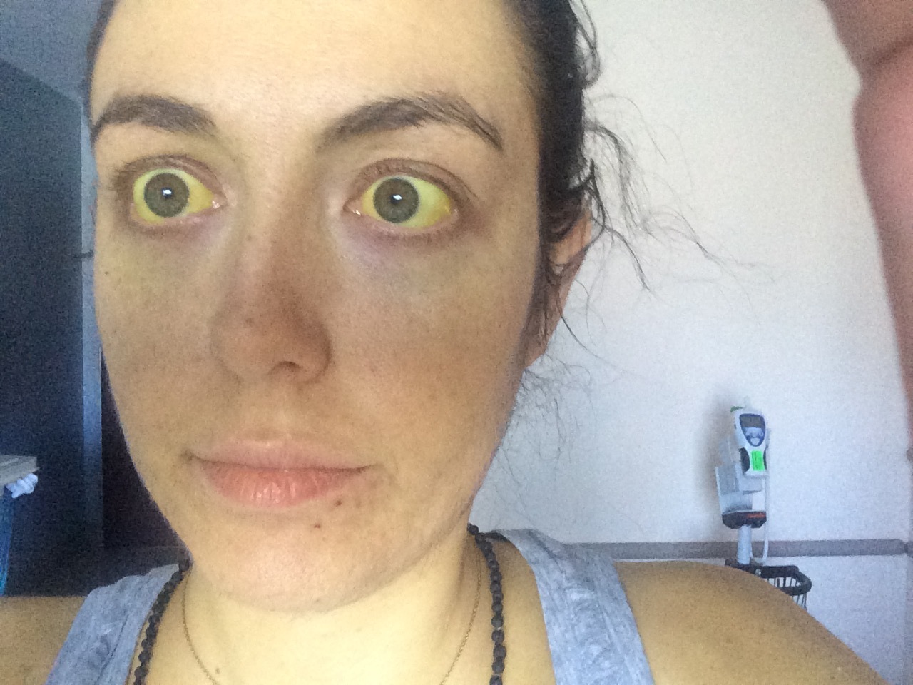Looking totally radioactive and kinda gross. Hospital stays are not good for your usually pleasing aesthetics.