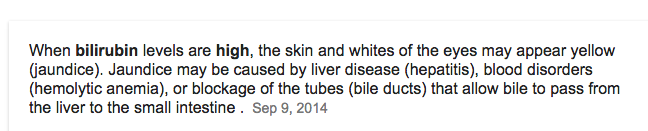 Source: Mayo Clinic.