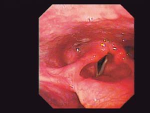7 Vocal Folds, Gertrude Contemporary: JARED DAVIS Valie Export, I turn over the pictures of my voice in my head , 2009, video still and performance documentation