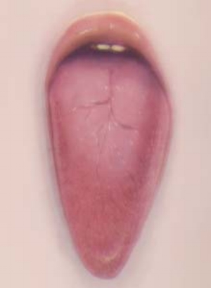 3 Pat Brassington: Under our skin: HEATHER ROSE Pat Brassington, Bloom , 2003, pigment print; image courtesy the artist, Arc One Gallery, Melbourne and Stills Gallery, Sydney