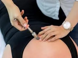 What is the Activator Technique?