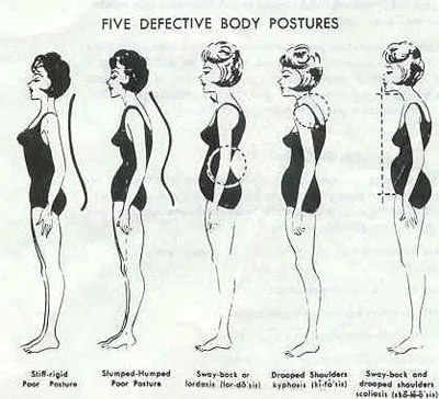 Posture Chart