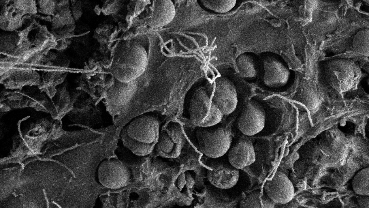 Microscopic view of bacteria eating plastic in the 'plastisphere.' Photo courtesy of Wikimedia.
