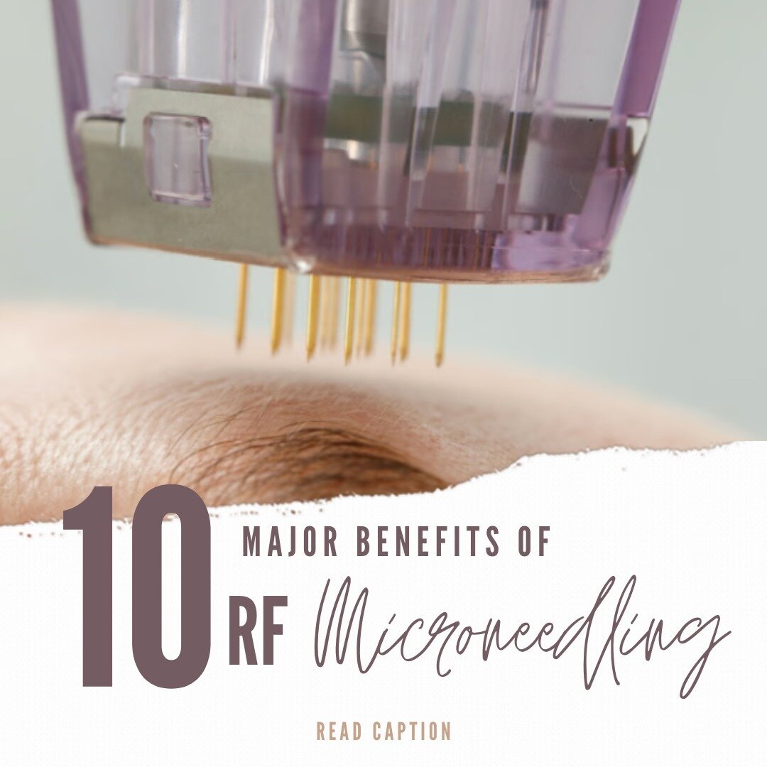 🌟✨ 10 major benefits of the magical Micro-Needling!

1. Collagen Boost: Stimulates collagen production for firmer, plumper skin.

2. Fine Line Reduction: Smoothens fine lines and wrinkles.

3. Tightened Skin: Improves skin elasticity and tightens sa