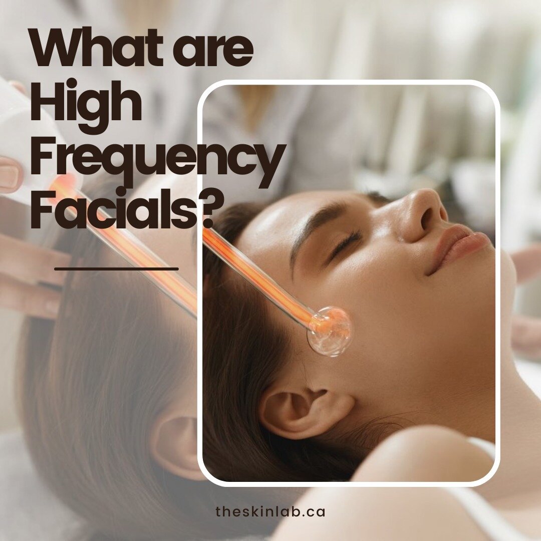High-Frequency is a natural treatment that utilizes thermal currents to treat fine lines, wrinkles, enlarged pores, cellulite, and under eye circles. 

High-frequency also oxygenates the skin and kills bad acne causing bacteria upon contact. 

⚡ Try 
