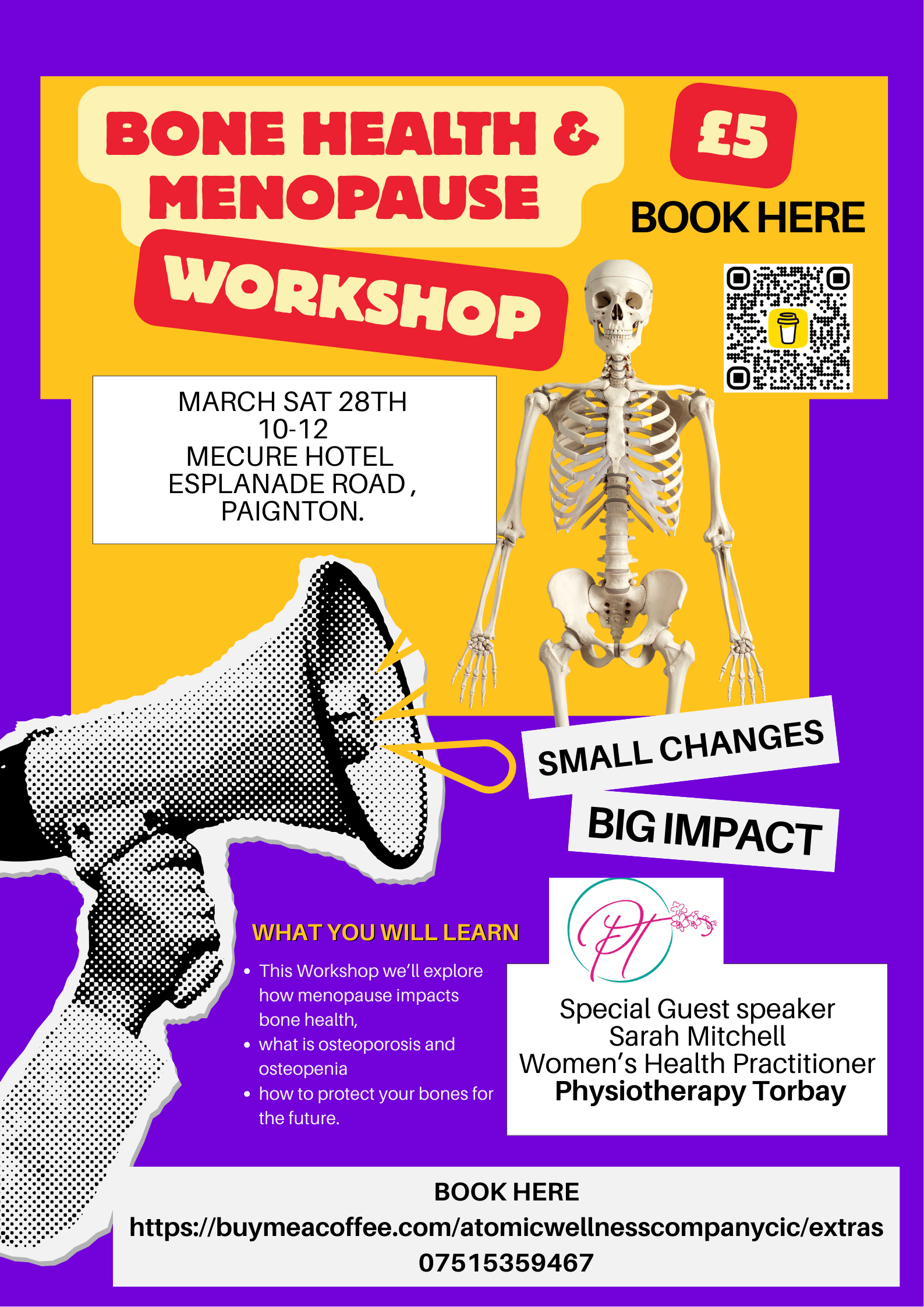 Bone Health in Menopause