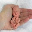 Fetus - 12 weeks