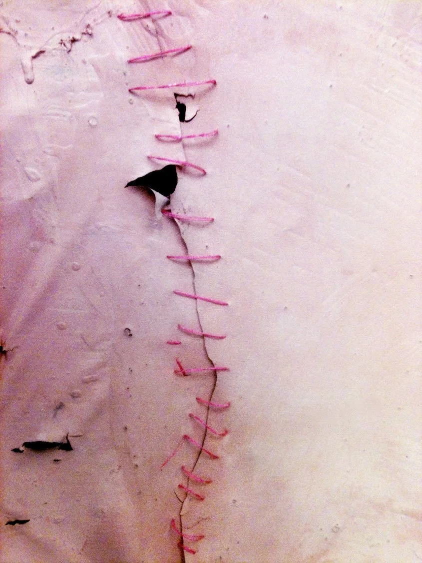 (Broken) Hymen reconstructed.jpg