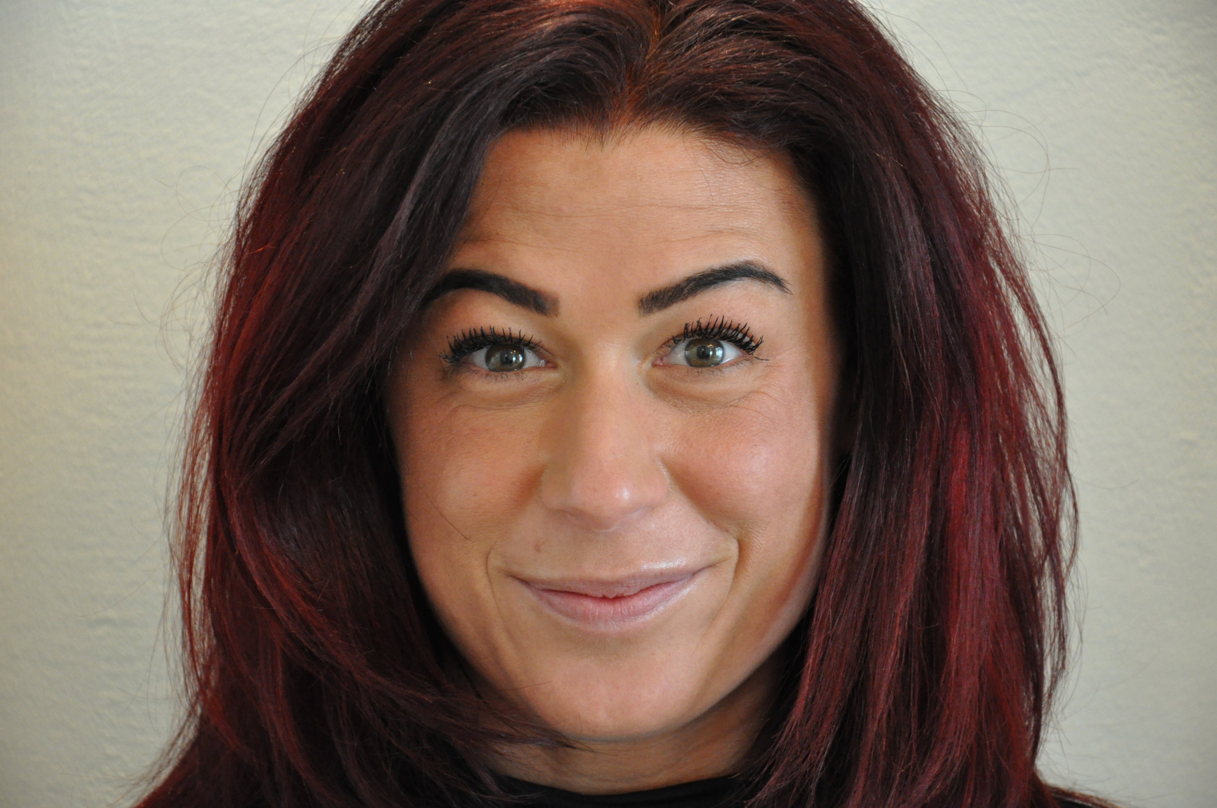 Botox 2.jpeg