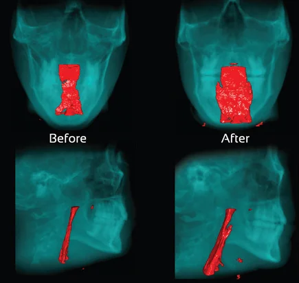 airway-image.jpg