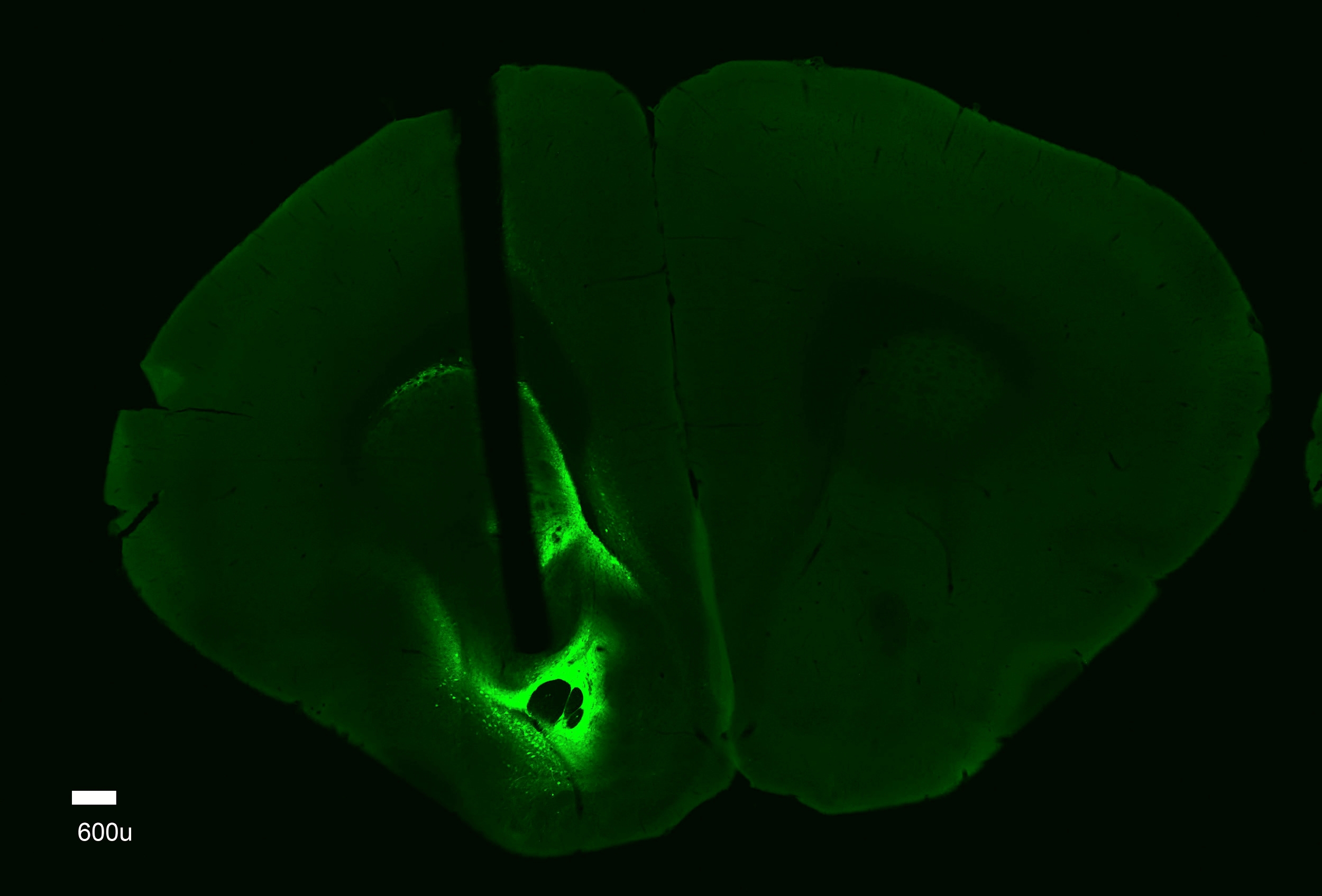 Vole557_Imaging_fullbrain_NAccCore_10xwithscalebar.jpg