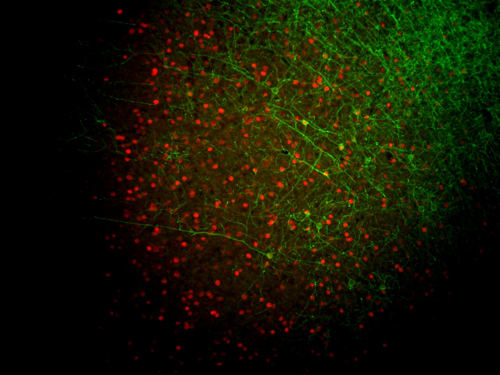 Ms9765_20x_cfos4dayCy3_gfp1dayCy2.jpg