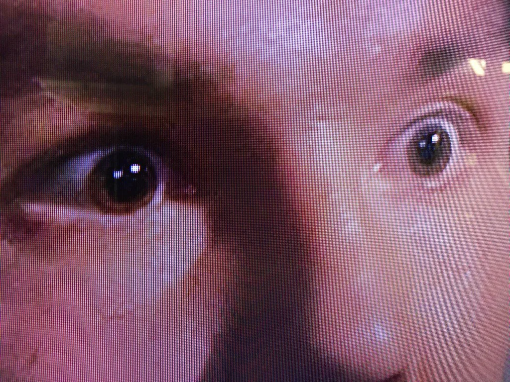 sam bradford eyes.jpg