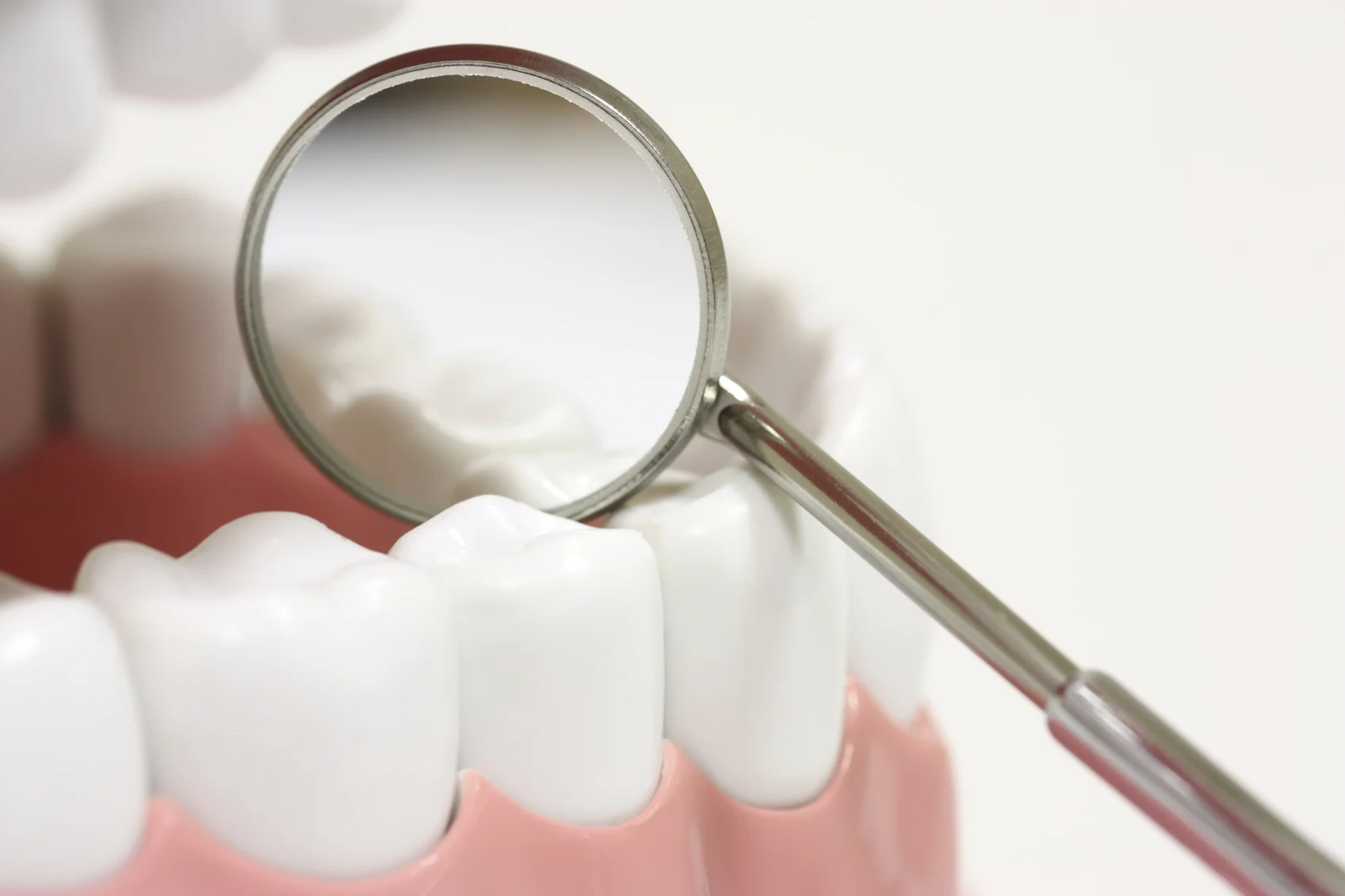 Metal Free Crowns & Fillings