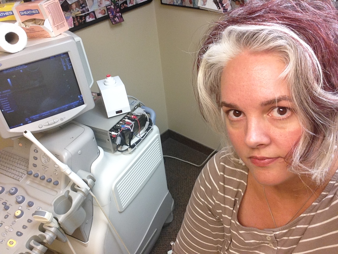 Doctor's office selfie. I was waiting for an ultrasound and preparing for an endometrial biopsy to rule out uterine cancer. (Both those showed clear and healthy results.) My stomach and esophagus not so much.