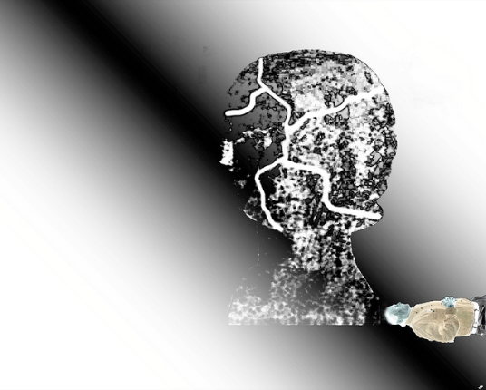 The Burden of Dealing with a Mentally Ill Family Member