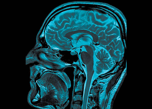 Despite Changes the NFL Has an Unaddressed Concussion Problem