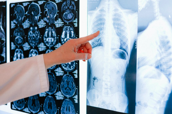 6 Self-Care Tips For When You're Recovering from an Accident, Illness, or Surgery