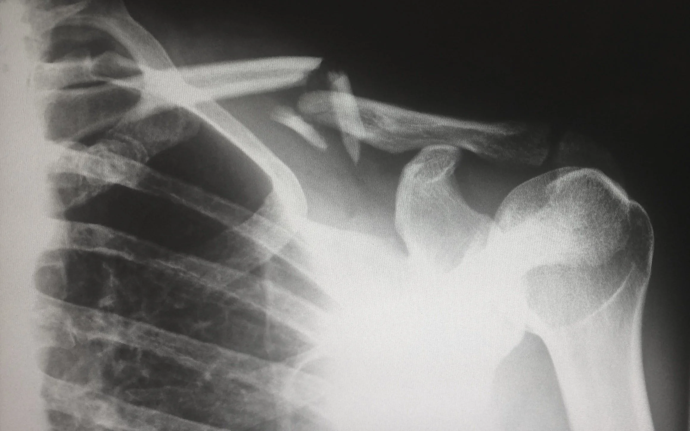 Maximizing Injury Claims – 5 Tips To Consider In 2022