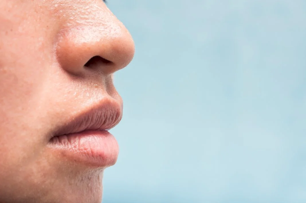 Dealing With Excess Oil and Oily Skin: Tips for a Healthy Complexion