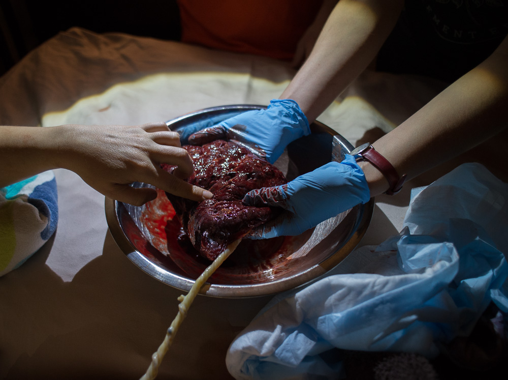 This cord still connects the placenta to the baby and the cord is visibly drained of blood