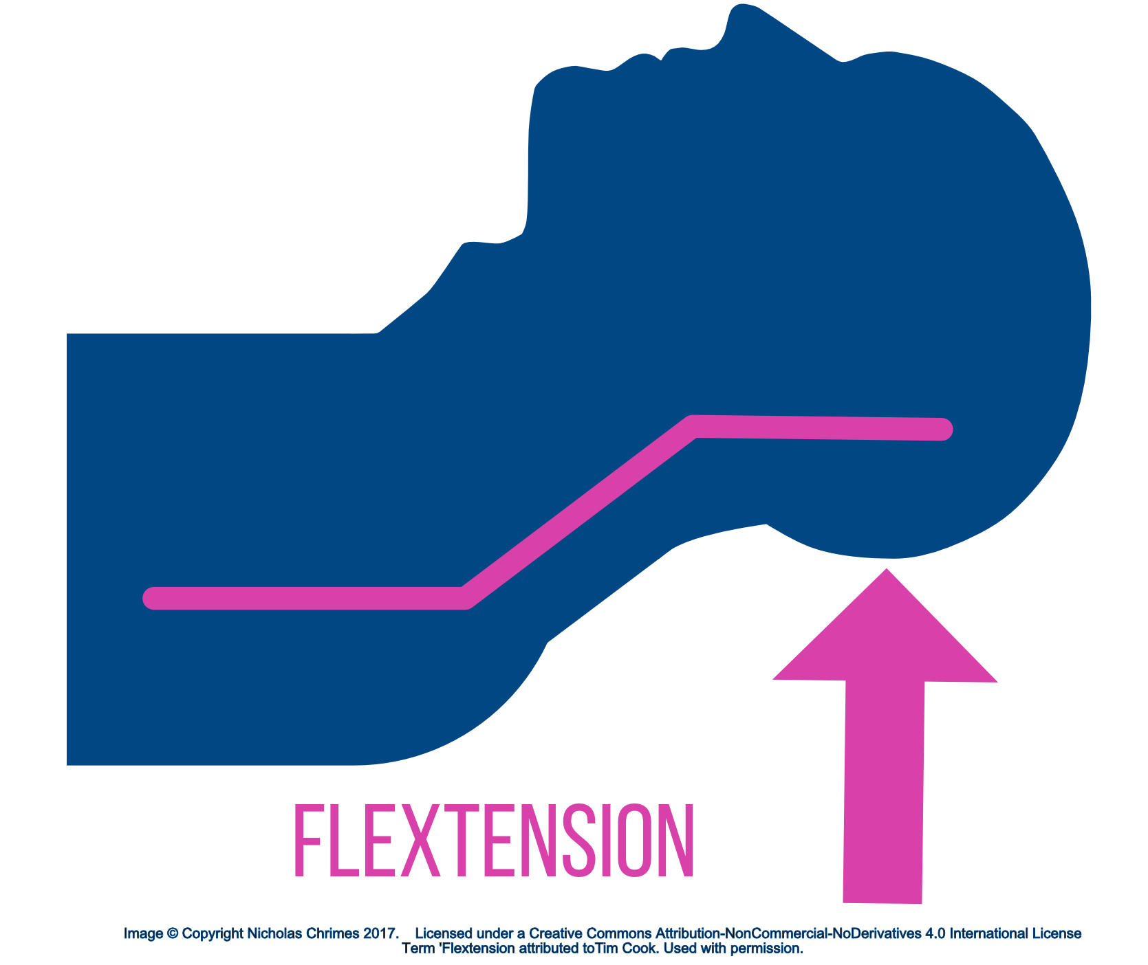 Flextension.jpg