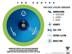 The Vortex Approach