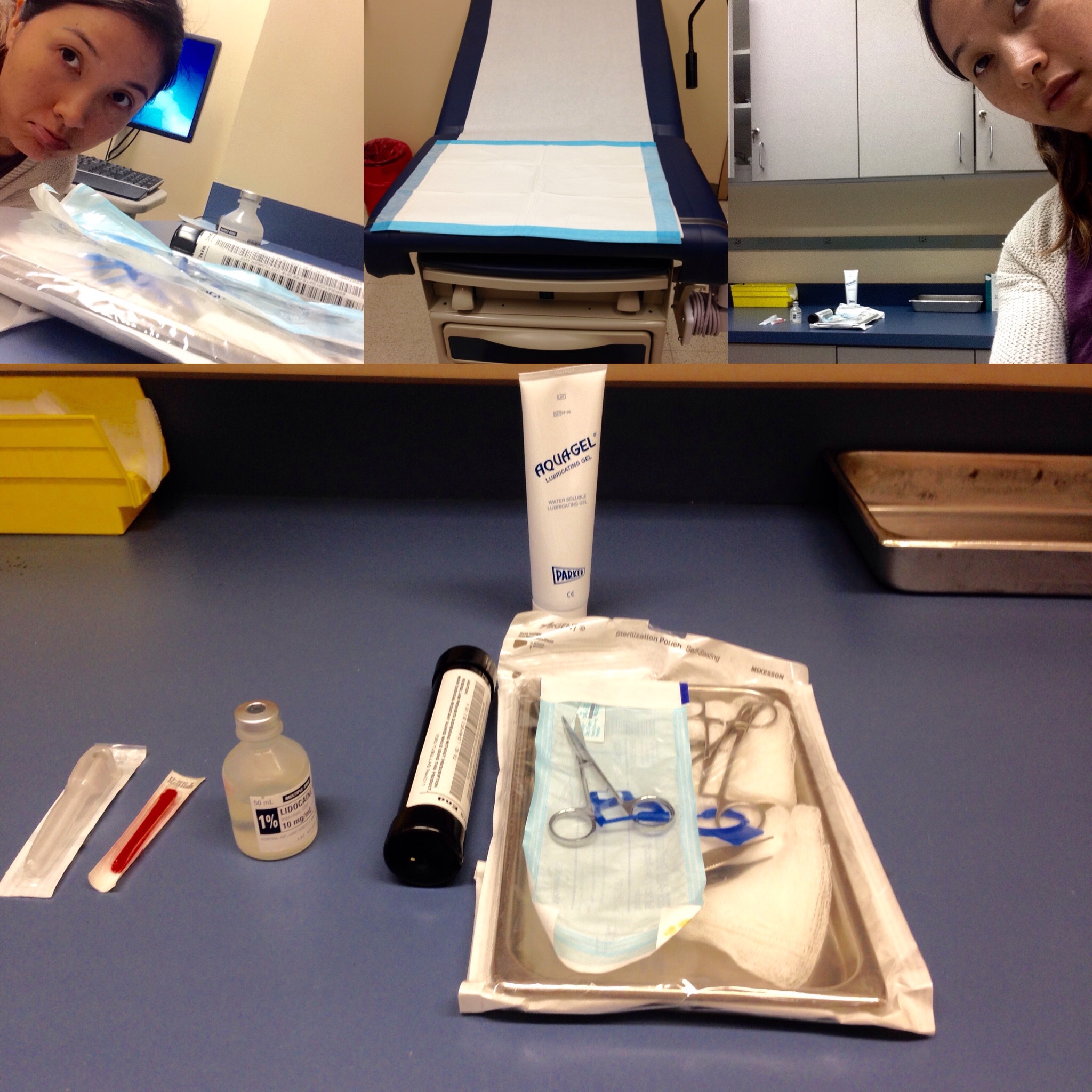 Getting granulation tissue removed (about 8 months postpartum)