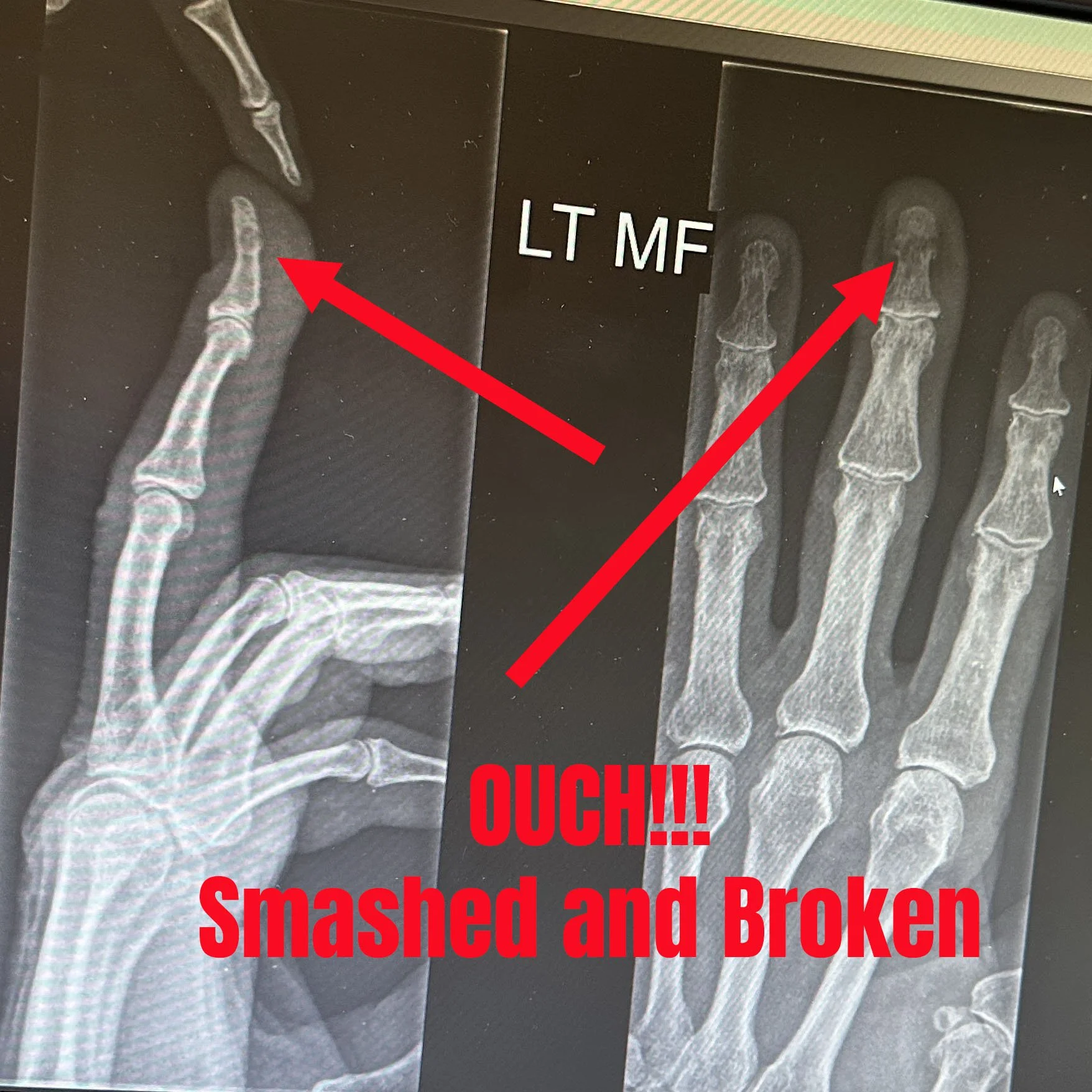 That's got to hurt!